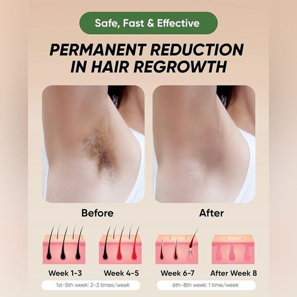 At-Home IPL Hair Removal For Men And Women Painless Hair Removal NIB - Picture 5 of 6